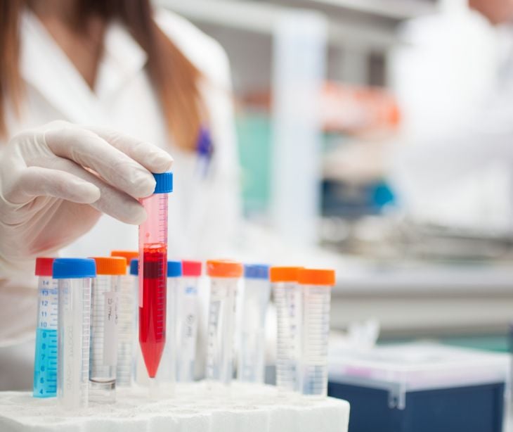 vials in a medical lab