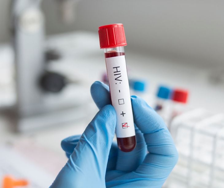 blood vial labeled HIV