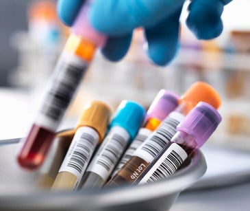 blood vials with barcodes held by gloved hand